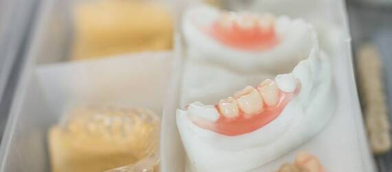 Mosty dentystyczne a estetyka uśmiechu – jak wpływają na wygląd?