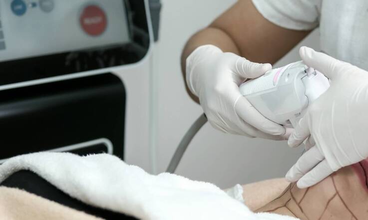 Czy endermologia LPG jest dla każdego? Wskazania i przeciwwskazania