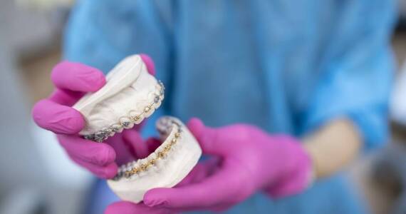 Kiedy ruchome aparaty ortodontyczne sprawdzają się lepiej od stałych?