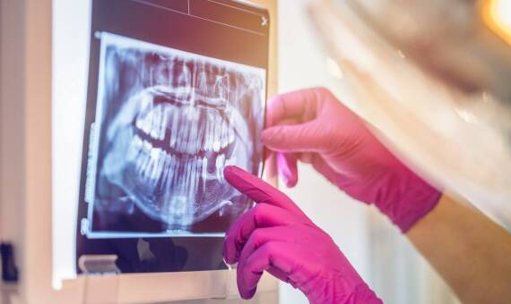 Najnowsze osiągnięcia w dziedzinie implantologii stomatologicznej