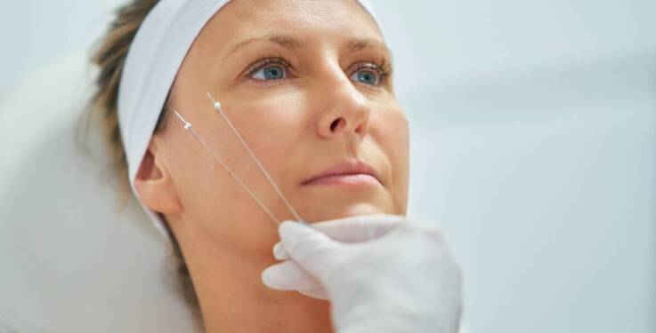 Nici PDO – dlaczego warto rozważyć ten zabieg na brzegu dolnym?