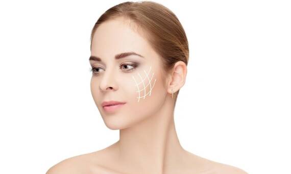 Czym są nici liftingujące? 