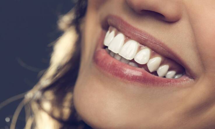 Licówki porcelanowe a wady zgryzu – czy to dobre rozwiązanie?