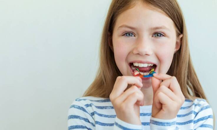 Jakie są korzyści z zastosowania aparatów ligaturowych w leczeniu ortodontycznym?