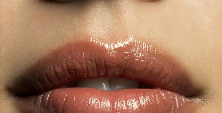 Jakie są koszty zabiegu powiększania ust kwasem hialuronowym?