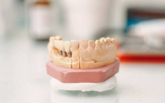 Regeneracja a naprawa – jakie rozwiązanie wybrać dla swoich protez?