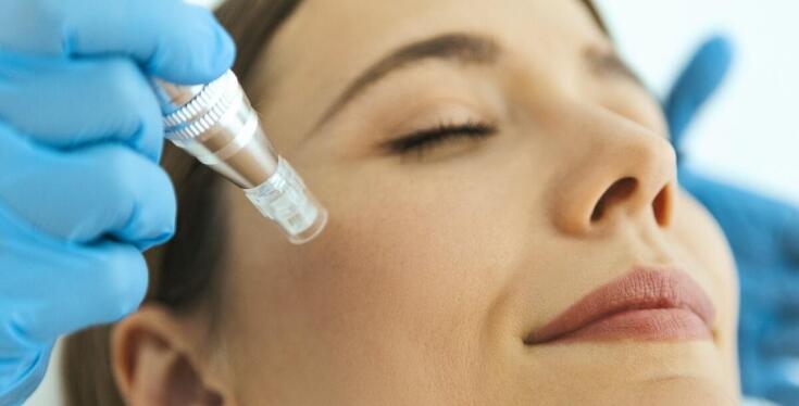 Dermapen a poprawa elastyczności skóry - na czym polega jego działanie?