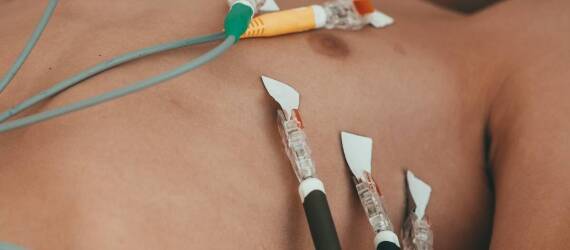 Wybór odpowiednich elektrod do EMG dla placówek medycznych