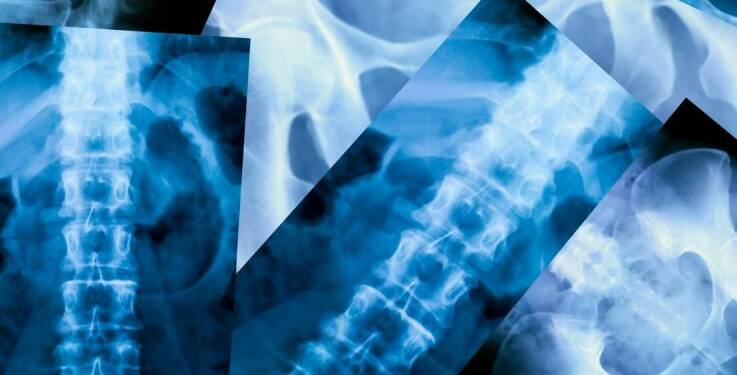 Porównanie RTG kręgosłupa lędźwiowego z innymi metodami diagnostycznymi