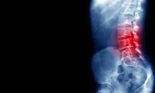 Jak rentgen kręgosłupa lędźwiowego wspiera planowanie rehabilitacji?