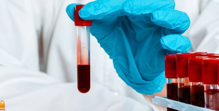 Zastosowanie wirówki do osocza bogatopłytkowego w chirurgii ortopedycznej