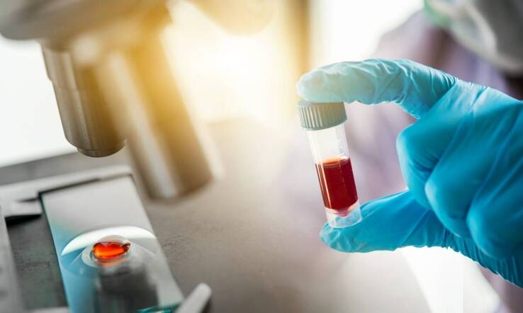 Osocze bogatopłytkowe a regeneracja skóry po uszkodzeniach