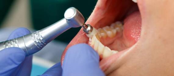 Higienizacja zębów a estetyka uśmiechu – dlaczego warto zadbać o regularne zabiegi?