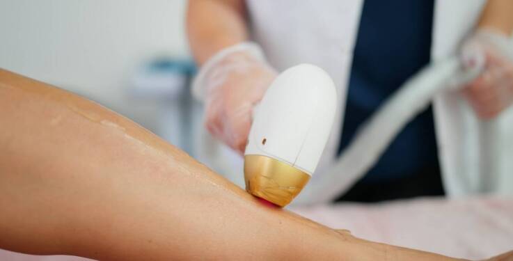 Jak epilacja laserowa może pomóc osobom z wrażliwą skórą?