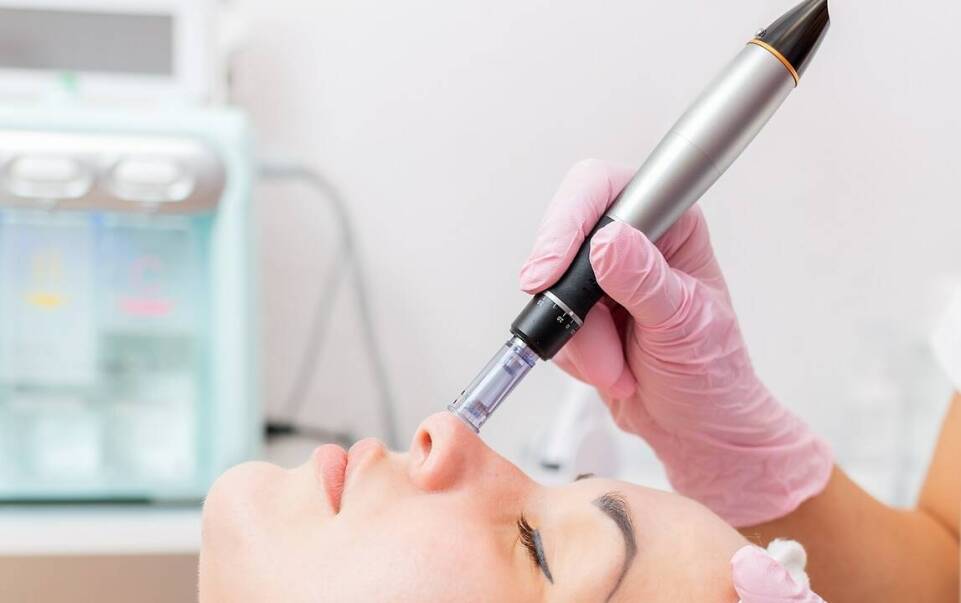 Wpływ mezoterapii igłowej na poprawę kondycji skóry twarzy