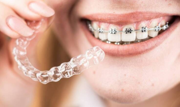 Jakie efekty można osiągnąć dzięki nowoczesnym metodom ortodontycznym?