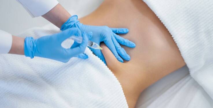 Najnowsze metody wyszczuplania brzucha - jak działa lipoliza iniekcyjna?
