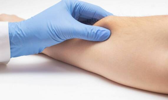 Hirudoterapia a problemy skórne: Naturalne metody łagodzenia objawów