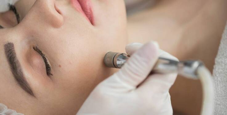 Mezoterapia igłowa jako wsparcie w walce z bliznami i przebarwieniami