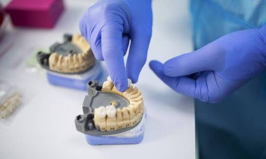 Efektywność mostów dentystycznych w rekonstrukcji braków zębowych