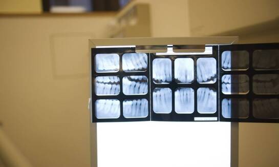 Jakie są zalety stosowania zaawansowanych systemów RTG w ortodoncji?