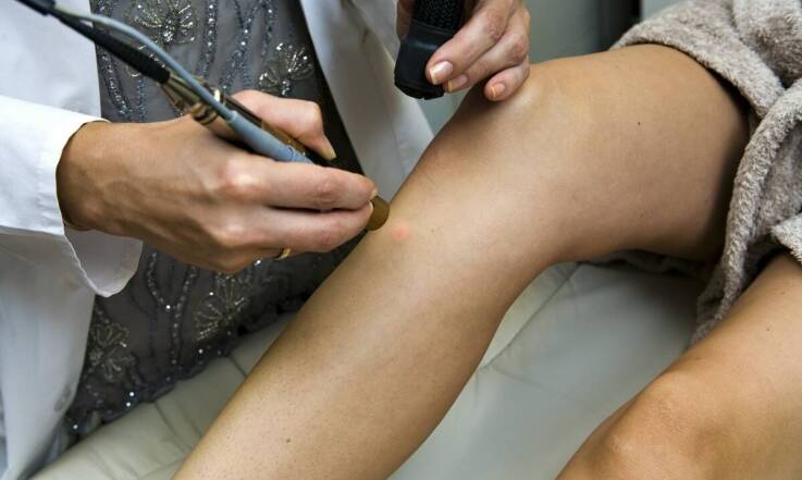 Jak punktowa laseroterapia przyczynia się do poprawy kondycji fizycznej?