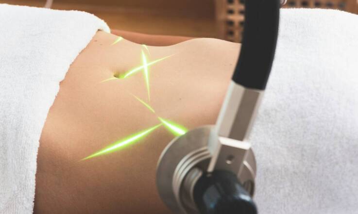 Jak elektrostymulacja pomaga w modelowaniu sylwetki?