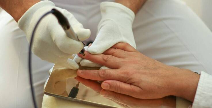 Specjalistyczne podejście do leczenia paznokci dystroficznych