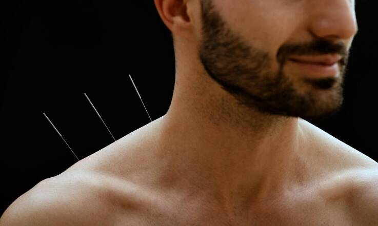 Znaczenie suchego igłowania w leczeniu mięśniowego napięcia