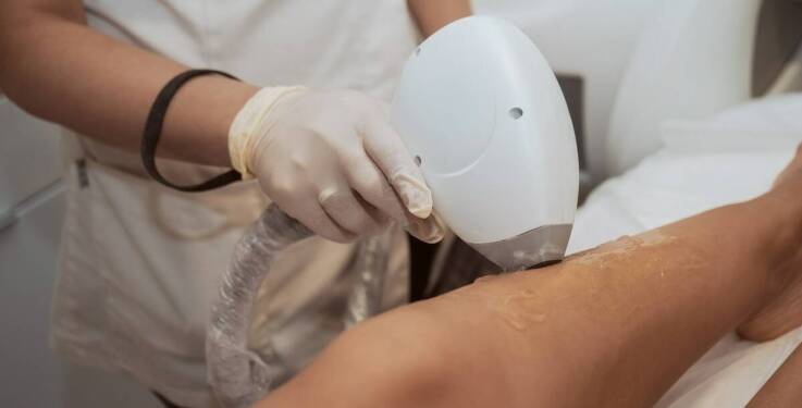 Jak laserowa depilacja wspiera codzienną pielęgnację skóry?