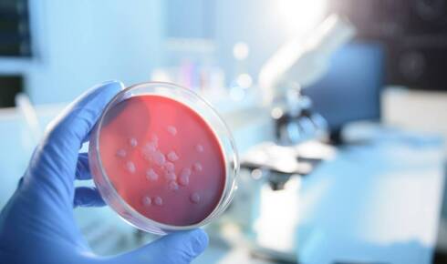 Jak mikrobiologiczne badania wspierają proces czyszczenia instalacji?