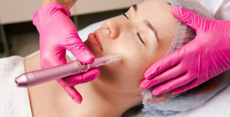 Jakie są zalety stosowania dermapenu do odmładzania skóry?