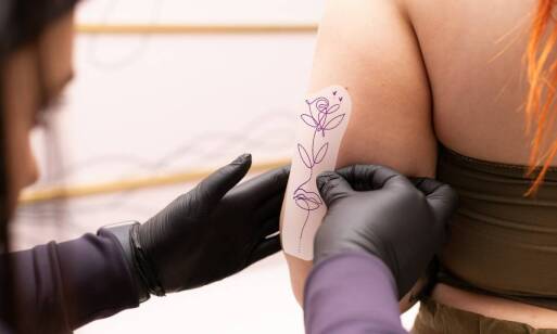 Co zrobić, aby przyspieszyć proces regeneracji skóry po usunięciu tatuażu?