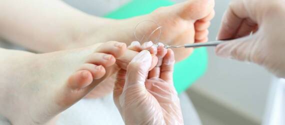 Podstawowe zabiegi podologiczne - jakie problemy mogą rozwiązać?