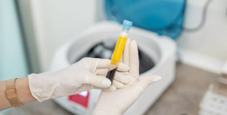 Wirówka do i-PRF: jak wybrać odpowiedni model dla swojej kliniki?