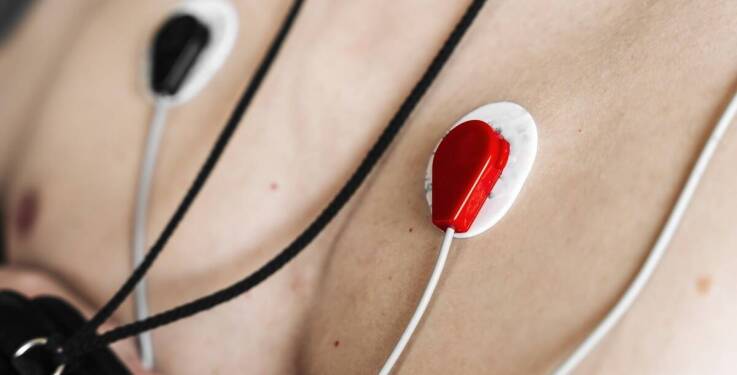 Spoczynkowe badanie EKG: kluczowy element profilaktyki chorób sercowych