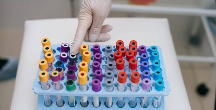 Jak badania krwi pomagają sportowcom w monitorowaniu zdrowia?