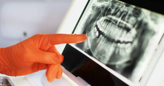 Jak nowoczesna technologia wspiera proces planowania zabiegów implantologicznych?