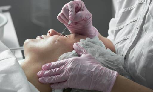 Igłowa mezoterapia: Czy jest skuteczna w redukcji zasinień pod oczami?