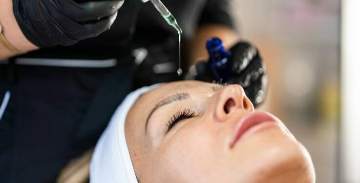 Dlaczego chemiczny peeling jest polecany przy trądziku?