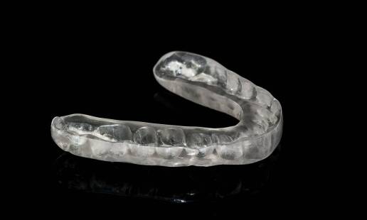 Jakie są kluczowe korzyści z noszenia nakładek ortodontycznych?