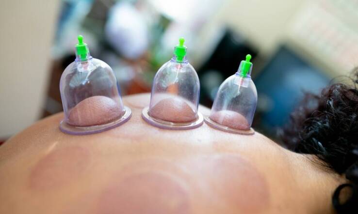 Jak chińska bańka do masażu wpływa na redukcję stresu?