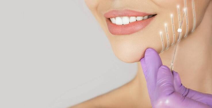 Czy nici PDO to skuteczna alternatywa dla chirurgicznego liftingu?