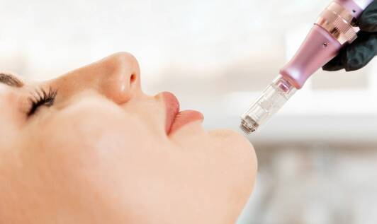 Mikroigłowa mezoterapia a zwiększenie produkcji kolagenu w skórze