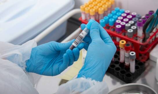 Skuteczność laboratoryjnej diagnostyki – jak wpływa na szybką diagnozę?