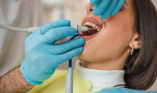 Jakie są najczęstsze metody usuwania nazębnego kamienia?