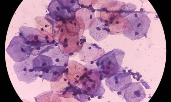 Cytologia, USG i test HPV — jak czytać zakres podstawowej diagnostyki