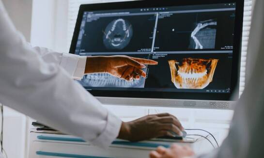 Kiedy tomografia 3D zębów pomaga znaleźć przyczynę bólu, urazu lub powikłań