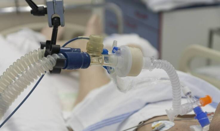 Silikon w rurce tracheostomijnej — kiedy liczą się elastyczność, tolerancja i dopasowanie u dorosłych